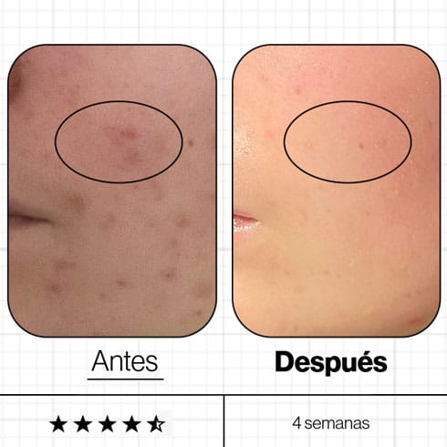 Advanced Nutrition Programme Skin Clear Biome 30 UDS