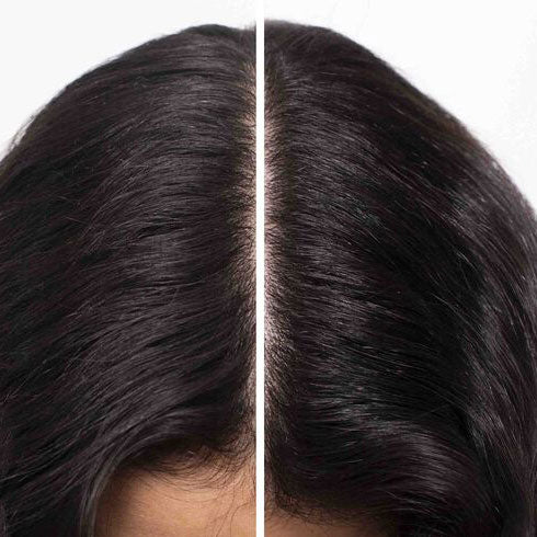 Shu Uemura Essence Absolue Nourishing Soothing Scalp Oil Concentrate 50 ML